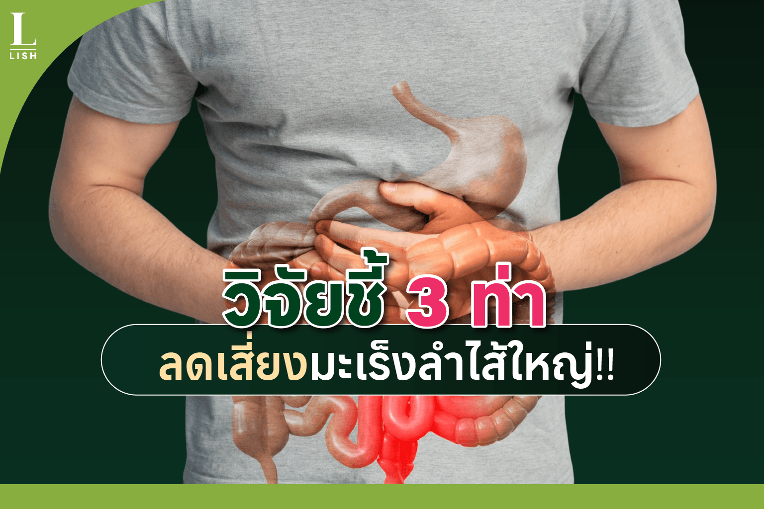 3 ท่าออกกำลังลดเสี่ยงมะเร็งลำไส้ใหญ่ ทำเองได้ง่ายๆ